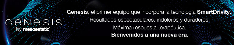 GENESIS - El primer equipo que incorpora la tecnologa SmartDivitry