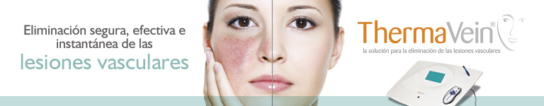 THERMAVEIN: la solucin para la eliminacin de las lesiones vasculares
