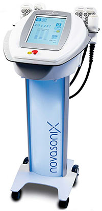 NSX, tecnologia patenteada e exclusiva de Novasonix