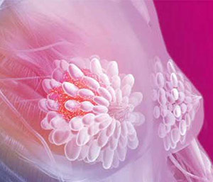 LPG desenvolve uma tcnica para tratar as sequelas do cancro da mama