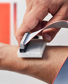 The sKan, um sistema que ajuda a detetar o cancro de pele