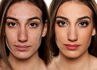 Maquilhagem teraputica: apoio esttico e psicolgico