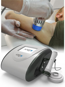 Eficacia en remodelacin corporal: tratamiento de ondas de choque radiales Adipo Wave