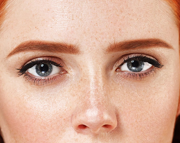 Aquela mancha que apareceu na pele...