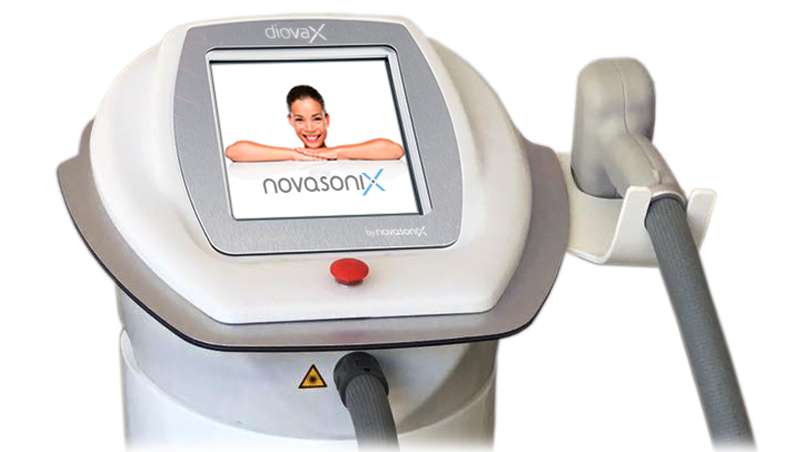 Diovax, la nueva estrella de Novasonix para una depilacin efectiva y segura