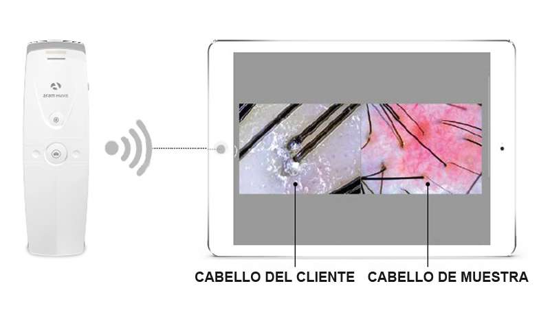 Quantum Technology presenta su equipo porttil de anlisis y diagnstico capilar: API 202