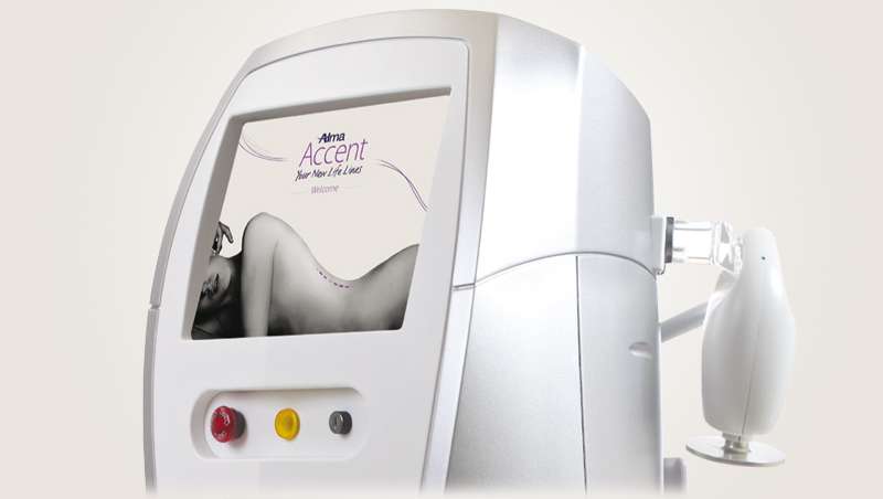 Alma Lasers Medica da a conocer Accent Prime, lo último en remodelación corporal y facial