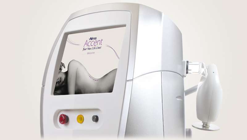 Alma Lasers Medica da a conocer Accent Prime, lo ltimo en remodelacin corporal y facial
