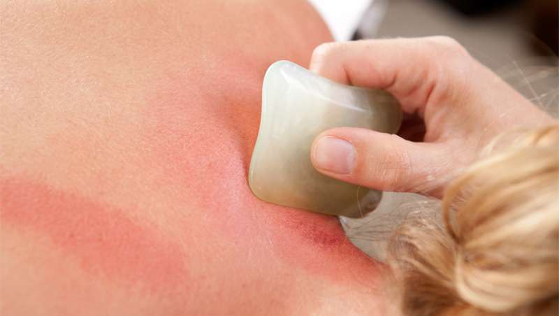 Gua Sha, tcnica tradicional chinesa para eliminar dores e embelezar a pele