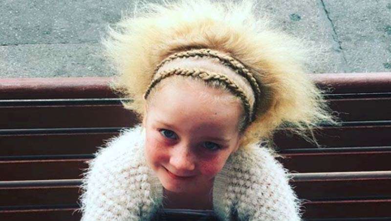 Famosa en Instagram gracias al sndrome del pelo impeinable