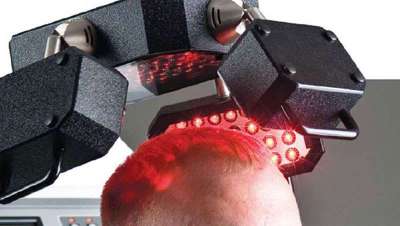 Elige el Servicio de Regeneración del Cabello FCC Hair y disfruta de nuevos y más clientes satisfechos