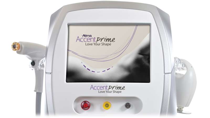 Accent Prime de Alma Lasers, ultrasonidos guiados para una remodelación corporal en 20 minutos