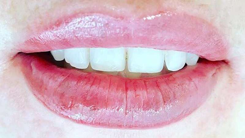 Definición y Volumen Anti-aging, solución para ganar volumen en labios sin rellenos