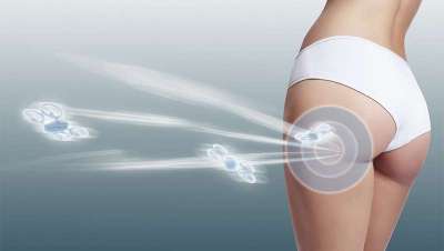 Focus Plan, el plan personalizado de belleza corporal de Germaine de Capuccini