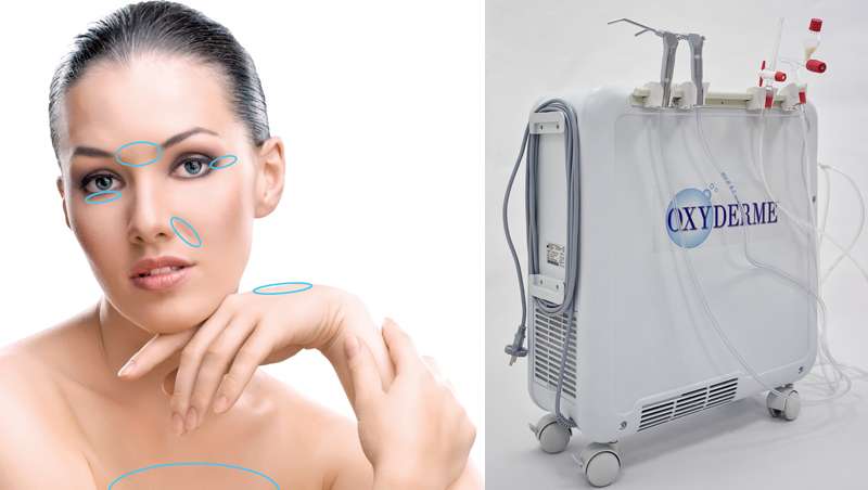 Oxyderme THBO, nueva tecnologa antiedad a base de oxgeno medicinal