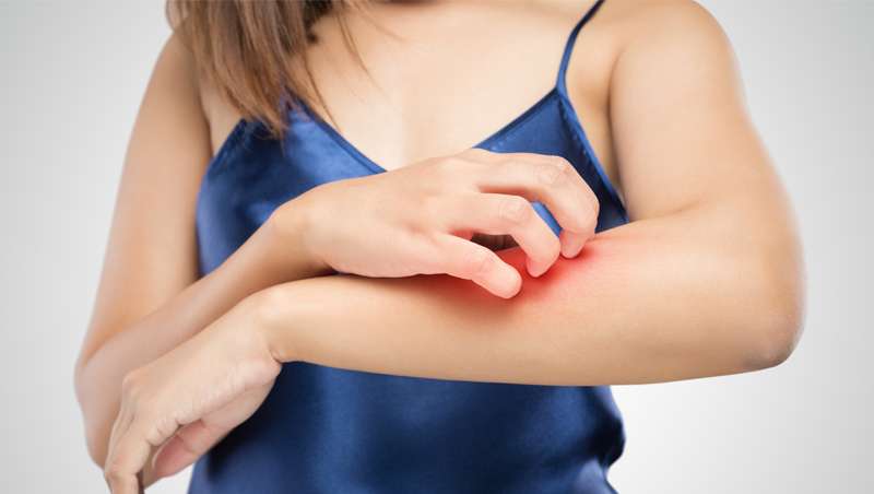 Skin Microbiome abordar nuevas perspectivas en el tratamiento de las alergias dermatolgicas
