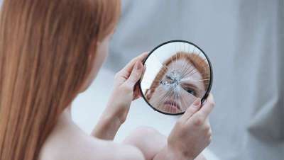 Conheces a dismorfofobia ou sndrome de distoro da auto-imagem?