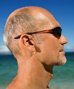 Los calvos, ms sensibles a la sobreexposicin solar en verano