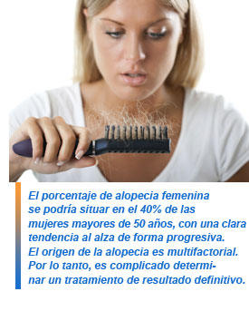 Alopecia femenina