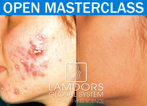 Acn, las claves para lograr resultados en cabina *live online*