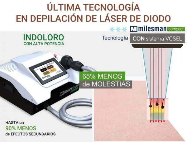 Alquiler de máquina laser de depilación - Milesman