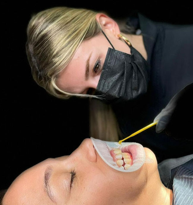 impieza bucal dentista
