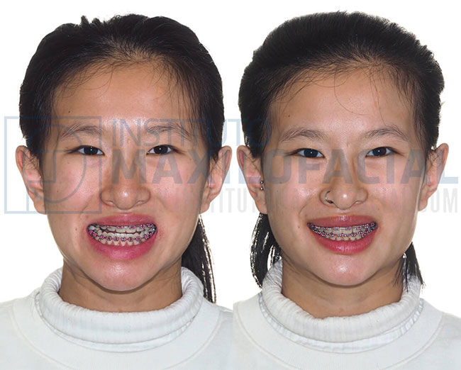 Cirugía Estética Facial - Instituto Maxilofacial