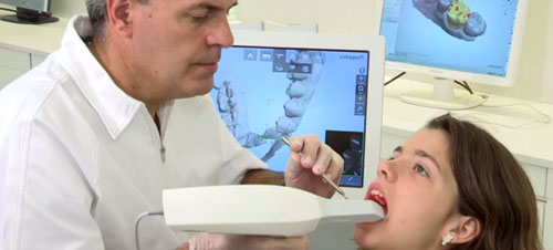 implante dental el un solo DIA
