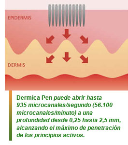 Dermica Pen
