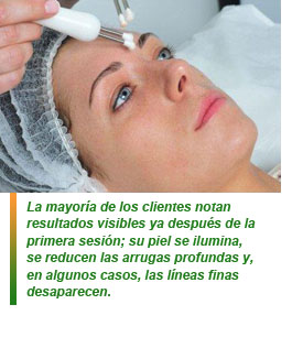 A-Lift, el equipo facial que estimula la piel para acelerar su propia regeneración