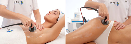 Indiba Deep Care cuanta con el aval de los cirujanos plásticos