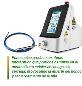 Láser de onicomicosis de Quirumed