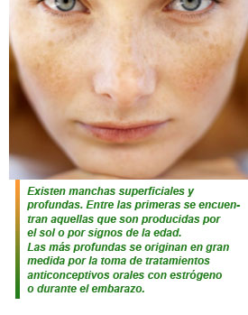 Lesiones pigmentarias benignas