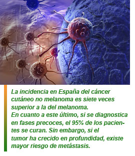 cáncer de piel