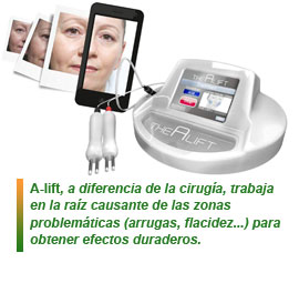 A-lift, equipo facial de Quartz Cosmetic