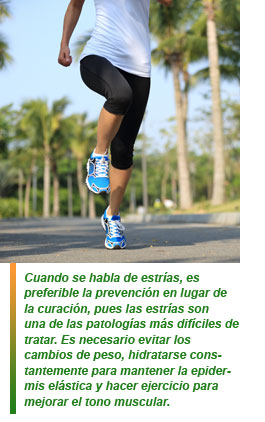 Las estrías y su tratamiento