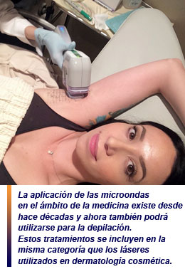 depilación definitiva con microondas