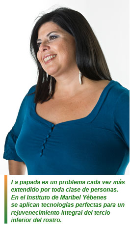 Maribel Yébenes tratamineto par papada