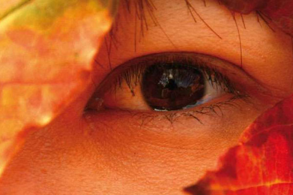 La cuperosis y su tratamiento