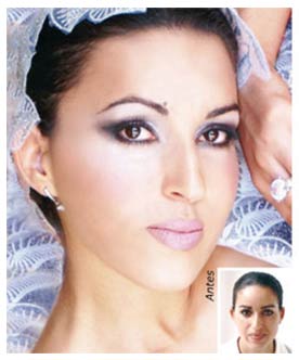 Maquillaje terapéutico: lesiones de la autoestima