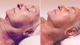 El jurado ha estado integrado por personal del departamento médico y de desarrollo de negocio de la empresa. Han dictaminado en base a las evidencias visibles en los resultados obtenidos