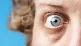 Está desarrollado por los expertos de Clínica Soft y su base es el ácido hialurónico