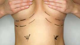 Va a realizarse el 19 y 20 de septiembre en Barcelona y está dirigido a fisioterapeutas, técnicos en estética y afines con conocimientos previos demostrables de anatomía cutánea y drenaje linfático 