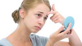 El acné, la fotoexposición excesiva y el daño solar o las enfermedades de transmisión sexual, son algunos de los problemas más frecuentes en la piel del adolescente