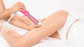 Se han podido reducir los tiempos de aplicación, entre otras acciones, para obtener incluso un mejor resultado contrastado con los estudios realizados por doctores