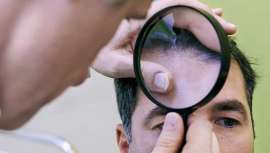 La tricología, ciencia que se ocupa del diagnóstico y tratamiento de las alopecias y los problemas del cabello, gana importancia en la dermatología