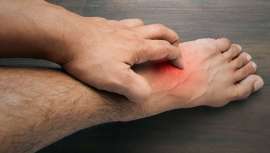 La Academia Española de Dermatología y Veneorología ha publicado una serie de informaciones y consejos sobre esta patología, que una de cada cinco personas sufre al menos una vez en la vida en su forma aguda