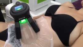 Epotam propone esta máquina de criolipólisis al alcance de cualquier centro de estética