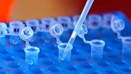 Obtiene marcadores nutricionales y funcionales que aportan una valiosa información para trazar dietas y perfiles de estilo de vida