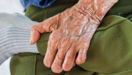 La Academia Española de Dermatología y Venereología quiere sensibilizar a la población sobre esta patología discriminatoria, ya que en la actualidad es curable y poco contagiosa, pero todavía existen muchos prejuicios sobre la misma